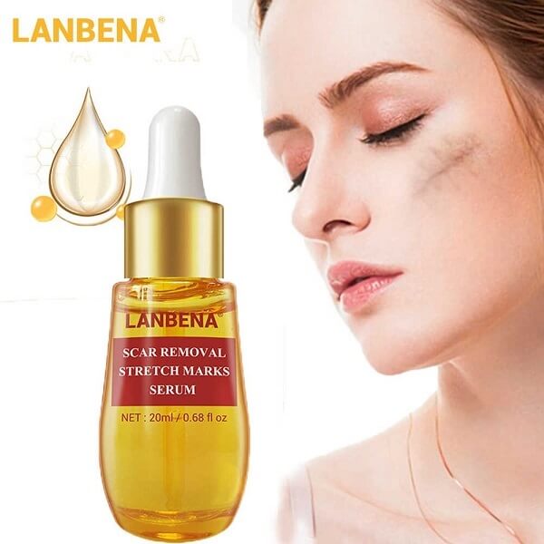 LANBENA ACNE SCAR REMOVE SERUM – 20ml